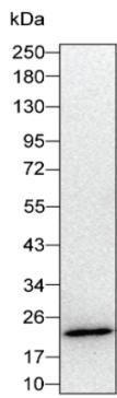 CMTM6